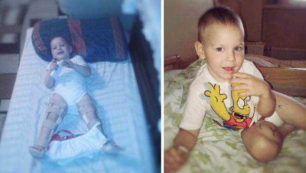 6-letni Adaś z Czarnochowic potrzebuje pomocy. Wesprzyj go! Trwa zbiórka na operację dzięki której zacznie chodzić.
