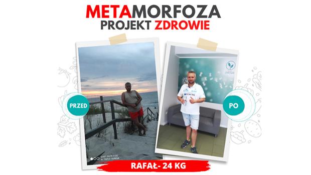 Spektakularna metamorfoza w Projekt Zdrowie! Pan Rafa schud 24 kilogramy!