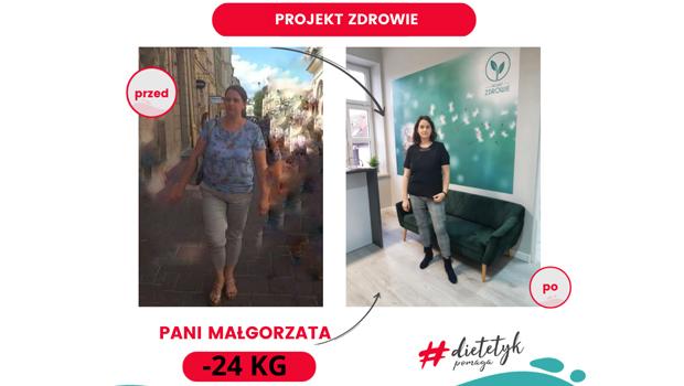 Spektakularna metamorfoza w Projekt Zdrowie! Pani Magosia schuda 24 kilogramy!