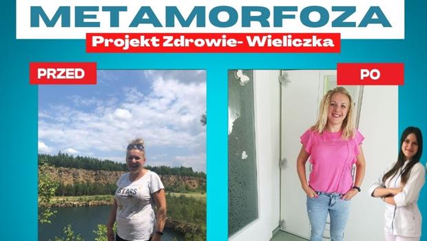 Metamorfoza w Centrum Dietetycznym Projekt Zdrowie Wieliczka - pani Anna schuda 15 kg
